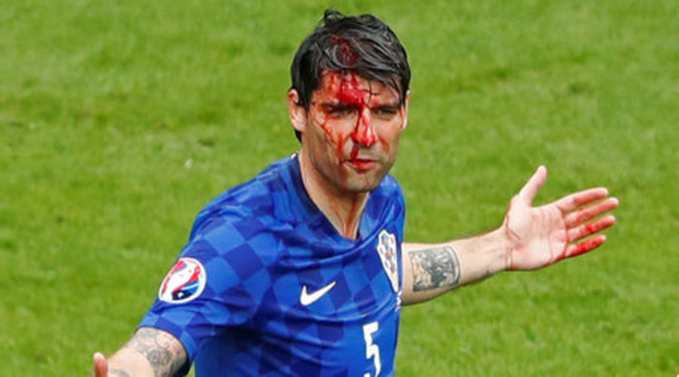 При единоборство Вердан Чорлука се удари лошо, но след това бе превързан и продължи да играе