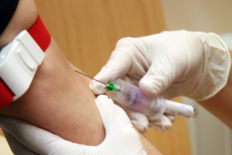 800 хиляди души годишно умират от хепатит С  