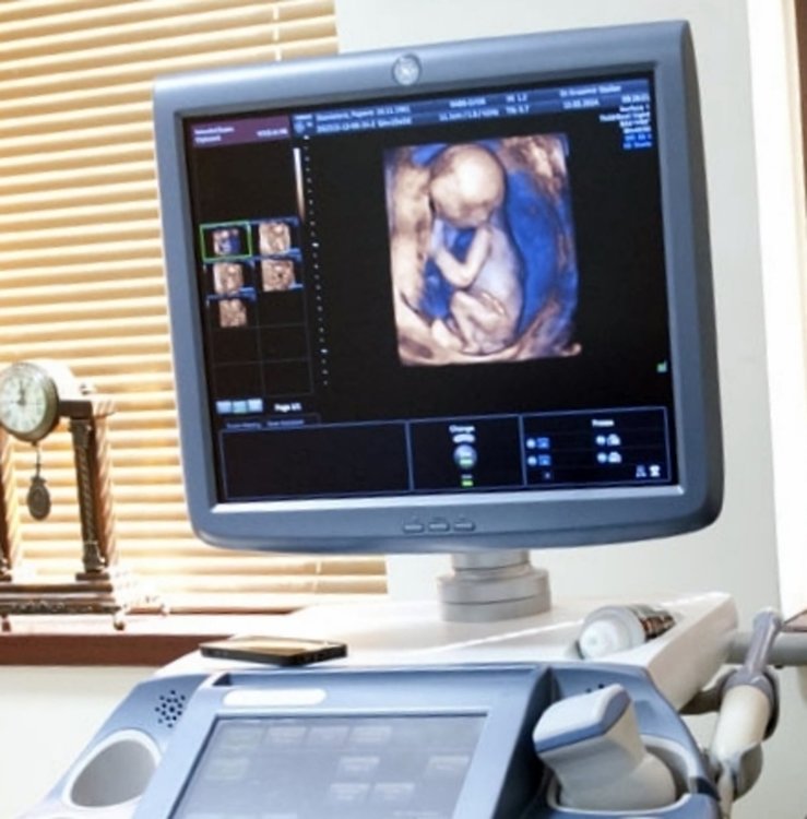 Родилното отделение в смолянската болница ще има модерен 4D видеозон