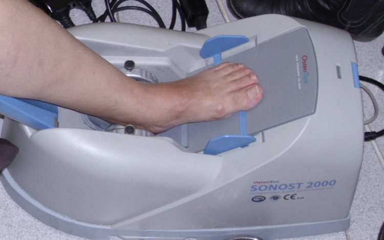 30 се прегледаха за остеопороза в Димитровград, през октомври пак