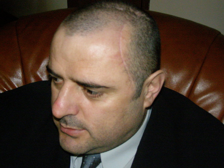 Малкия Роко