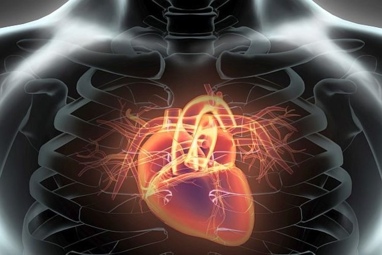 Почина пети пациент с изкуствено сърце във Франция