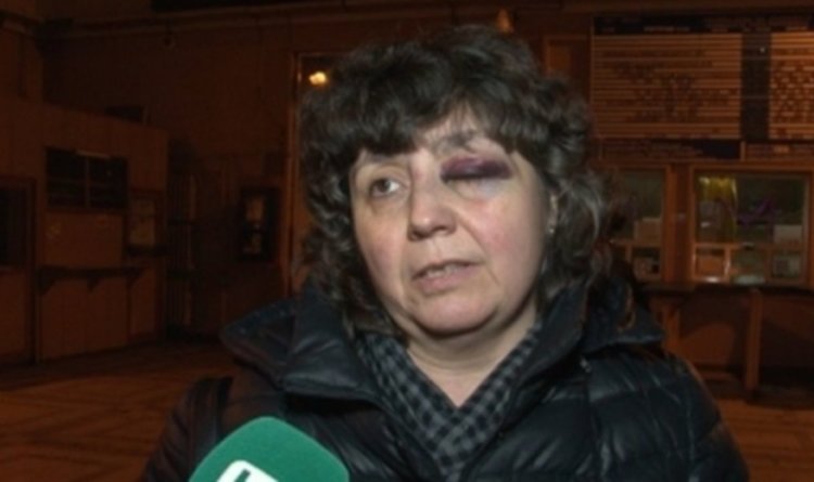  Жена е с мозъчно сътресение след удара на локомотив в Мездра