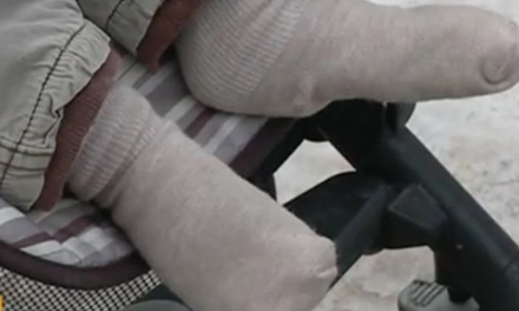 Откраднаха кола, с която дете ходи на рехабилитация