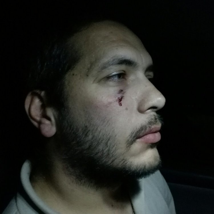 Нападнаха репортер и оператор на Нова телевизия на магистрала „Тракия”