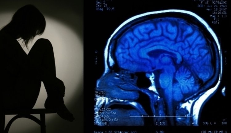 Тразодон вече се ползва срещу депресия, 