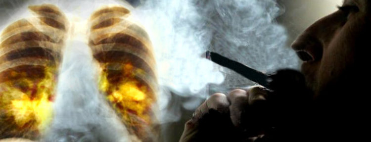 Как се отказват цигарите? Лекари търсят отговор в деня без тютюнев дим - 31 май