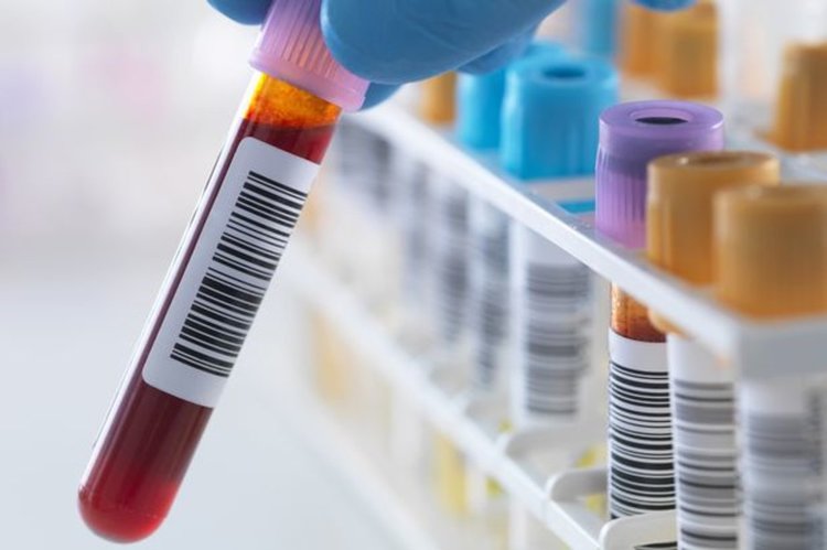 Млада майка диагностицирана с деменция