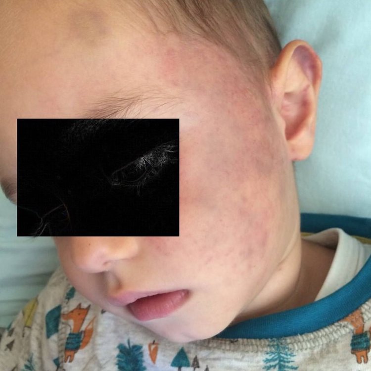 Обвиниха учителка в ясла за побой над 2-годишно