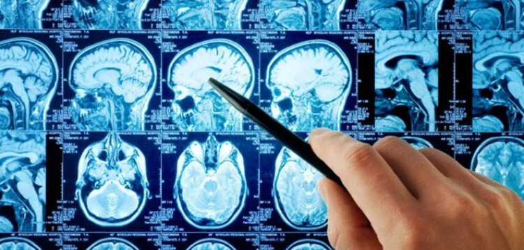 Над 25% от българските лекари са в пенсионна възраст