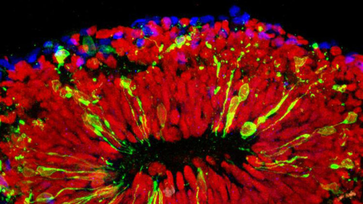 Имплантираха човешки мозъчни клетки в мозъка на жив плъх