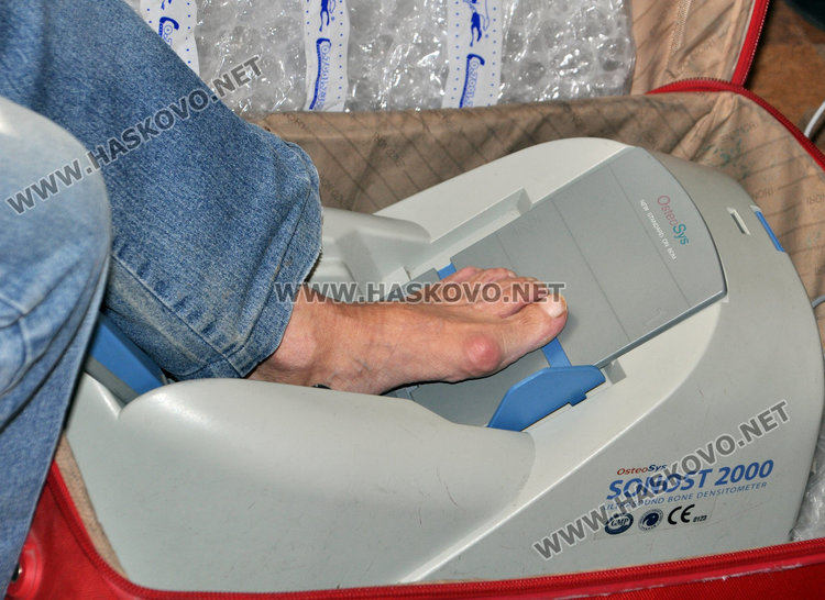 Всеки пети мъж в риск от остеопороза