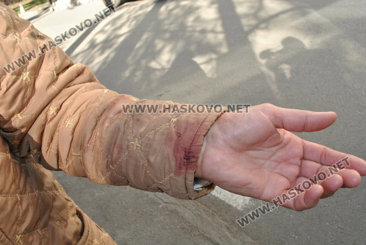 Овчарско куче нахапа зверски съсед на президента Румен Радев