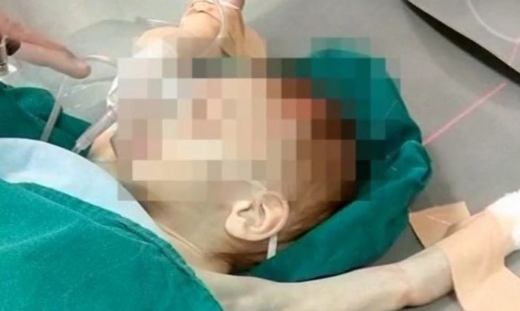 Пуснаха майката на недохранените близнаци, те – в болница