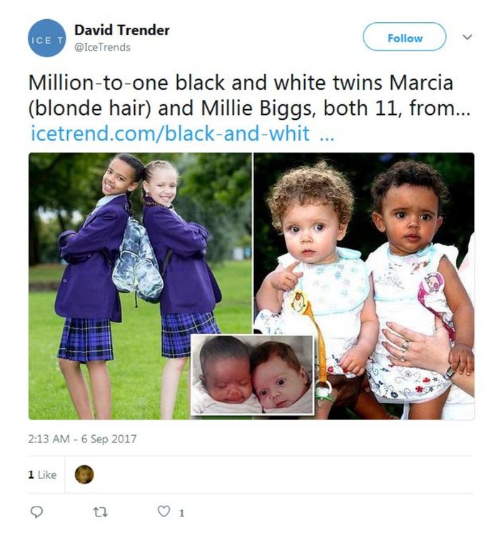 Близначки с различен цвят на кожата се превърнаха в истинска сензация