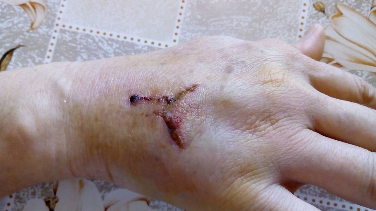 Куче нахапа пенсионерка пред блока й