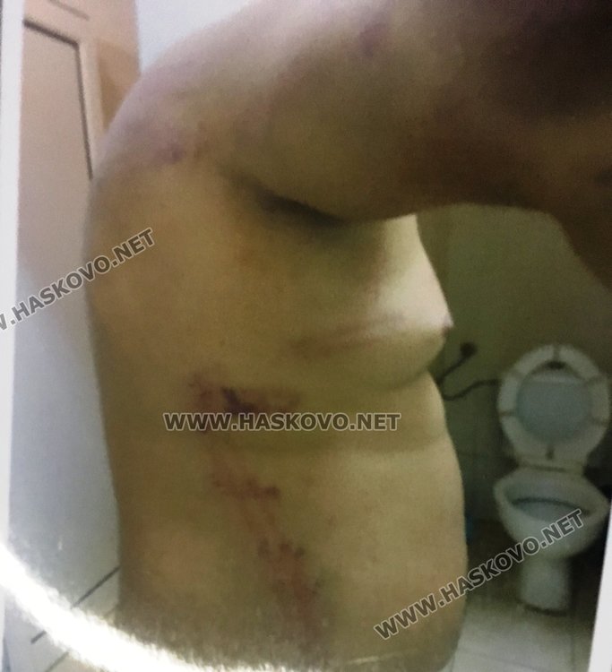 Съдът освободи срещу 6500 лева катунаря, ранил хасковски полицай