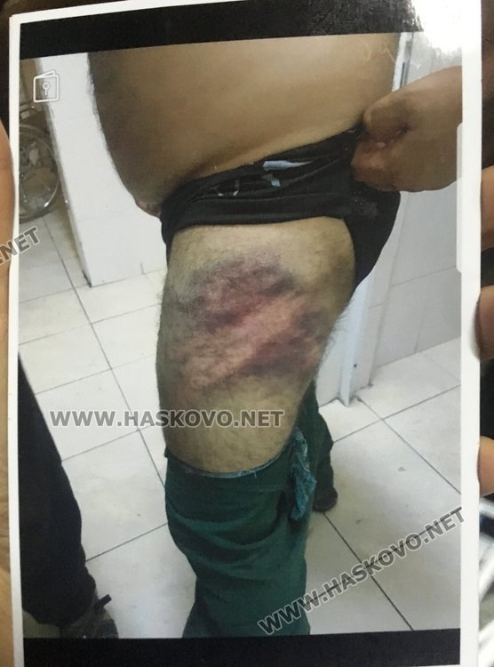 Съдът освободи срещу 6500 лева катунаря, ранил хасковски полицай