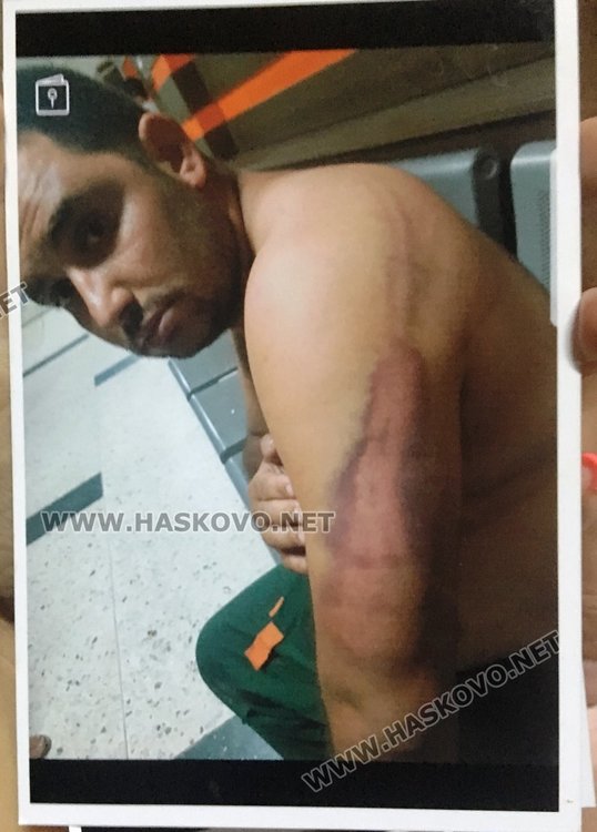 Съдът освободи срещу 6500 лева катунаря, ранил хасковски полицай