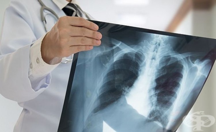 Безплатно изследват за туберколоза в смолянската болница, дори и неосигурените