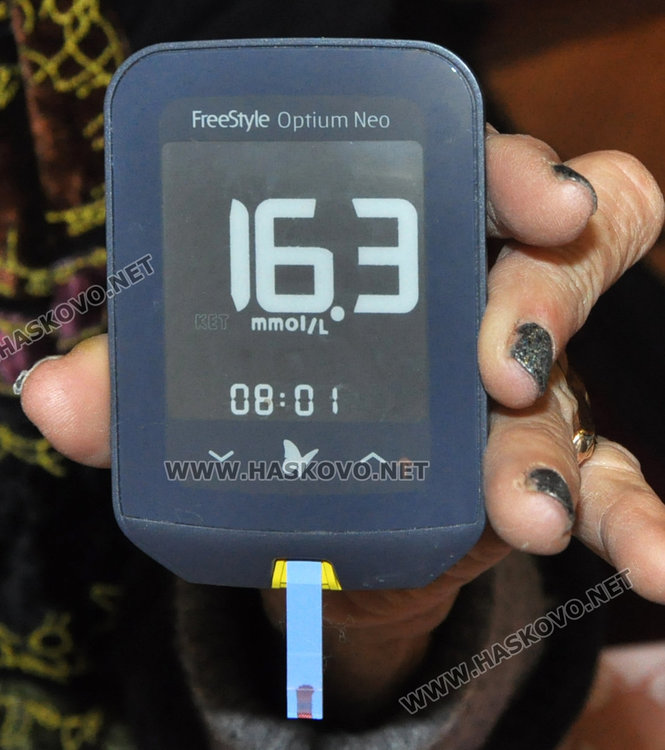 Измерват безплатно кръвна захар в Световния ден за борба с диабета