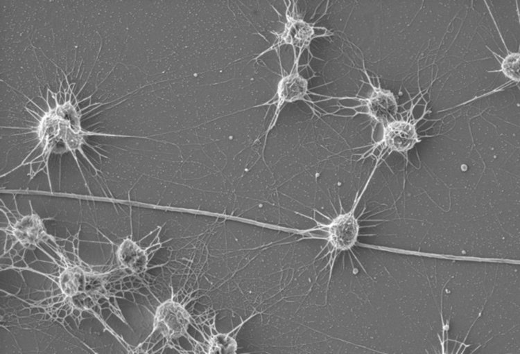 Археа, наречена Altiarchaeales живее в сулфидни извори в Германия. Кредит: Christine Moissl-Eichinger/Medical University of Graz, Austria