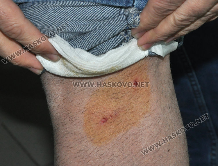 Бездомно куче нахапа мъж в центъра на Хасково