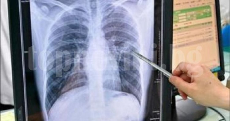 Седмица на отворени врати в болницата, преглеждат безплатно за туберкулоза