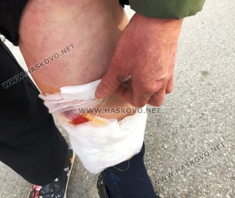 Бездомно куче нахапа жена в Хасково