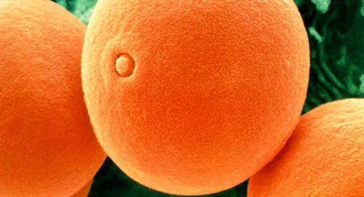 Пелин, размер на зърната 20-50 микрона. Снимките са на  швейцарския фотограф Мартин Огерли.  Алергенен прашец на растения, които се опрашват от насекоми, почти няма. Той е лепкав и се пренася на къси разстояния, бързо пада и рядко предизвиква алергии. Изключение са някои растения, които произвеждат много цветен прашец като детелината (люцерната).