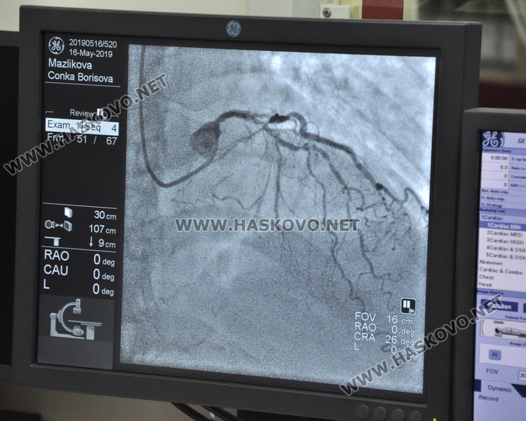 Масивните инфаркти покосяват в Хасково като при епидемия