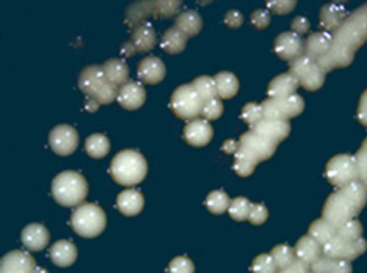 Щамът бирени дрожди EBEgT12, изолиран от съд в обекта Ен-Басор, Израел. Кредит: Aouizerat et al, doi: 10.1128/mBio.00388-19.