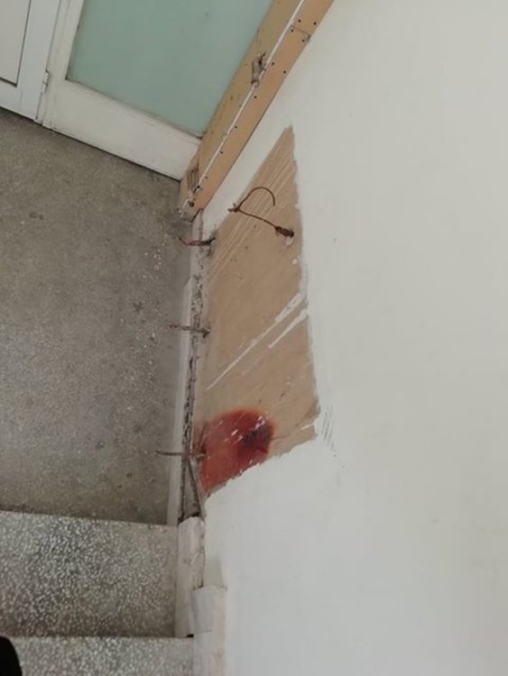 Мизерия в АГО потресе хасковлийка. МБАЛ чака половин милион за ремонт