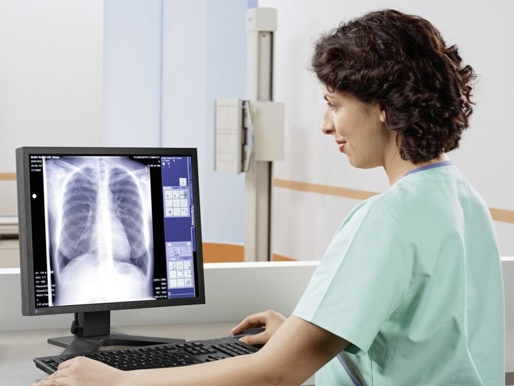 Димитровградската болница с нов дигитален рентгенов апарат