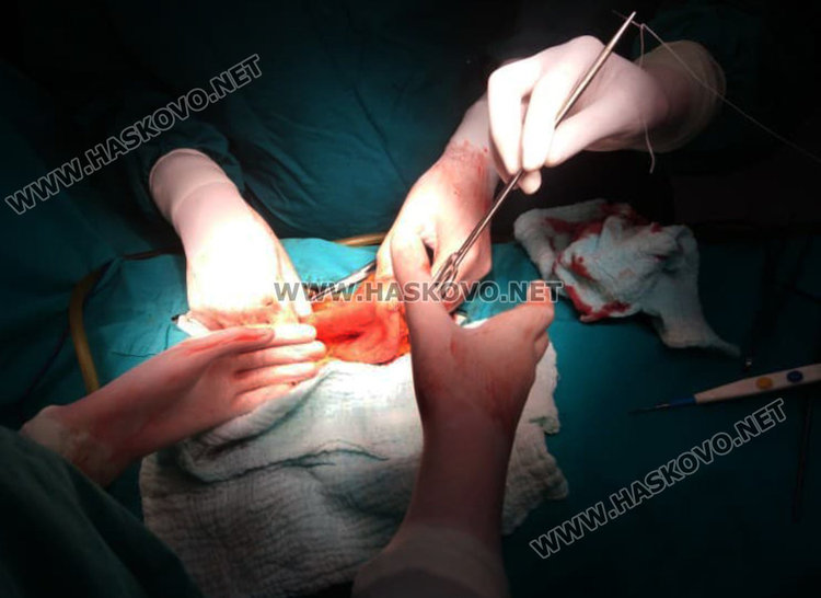 Хирурзи откриха рядко образувание в корема на хасковлия (видео) 