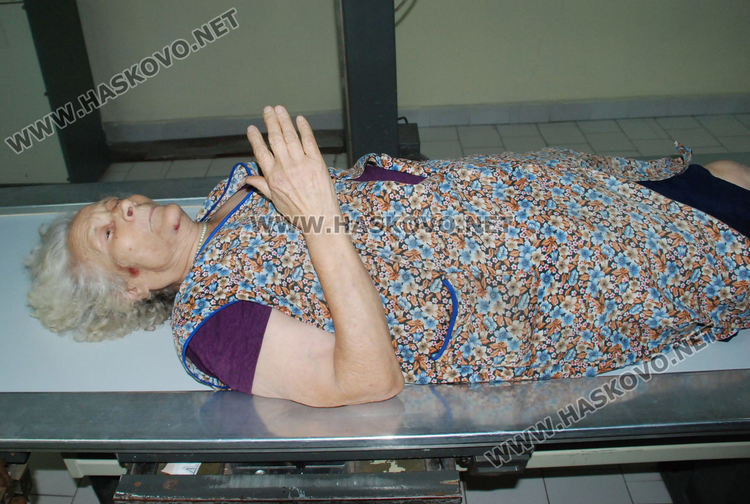 Пострадалата жена а