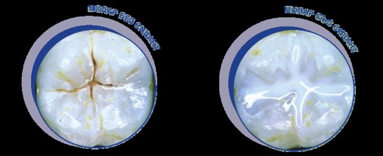 снимка: eo-dent.com