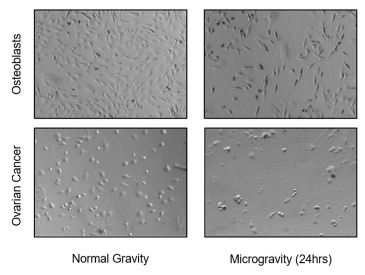 Микрогравитацията унищожава раковите клетки