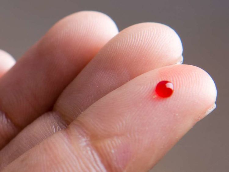 Болен от СПИН установиха в лекарска практика в Кърджали