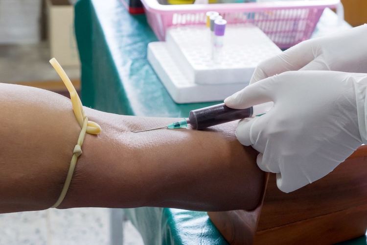 Полицията в Турция разкри български канал за трафик на органи 