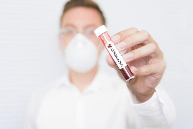 Двама граждани на Северна Македония са заразени с коронавирус