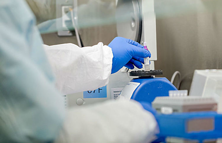 Почина 74-годишният пациент, при който беше потвърден COVID-19