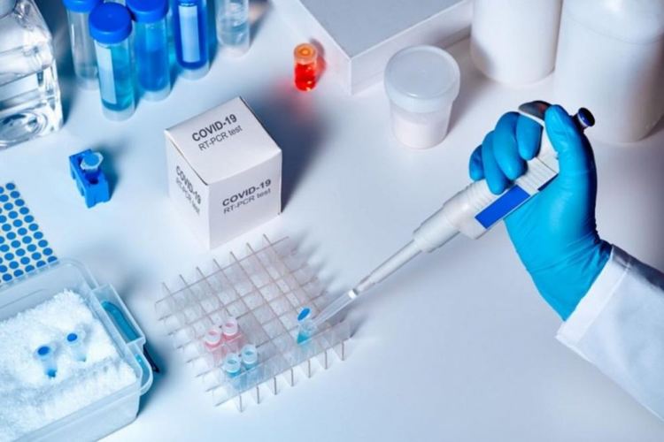 В Пловдив: Лаборатории Рамус и Пълмед тестват с PCR метод за коронавирус
