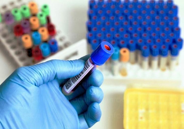 В Смолян от днес частна лаборатория прави тестове за коронавирус, ДКЦ също чака тестове