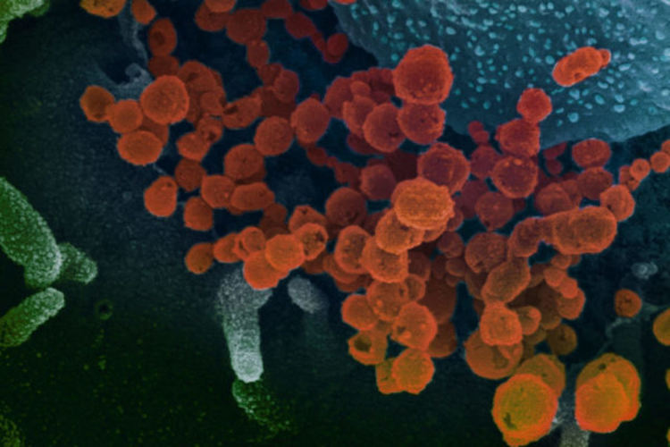 Още една смърт от COVID-19 у нас. Нови 10 случая