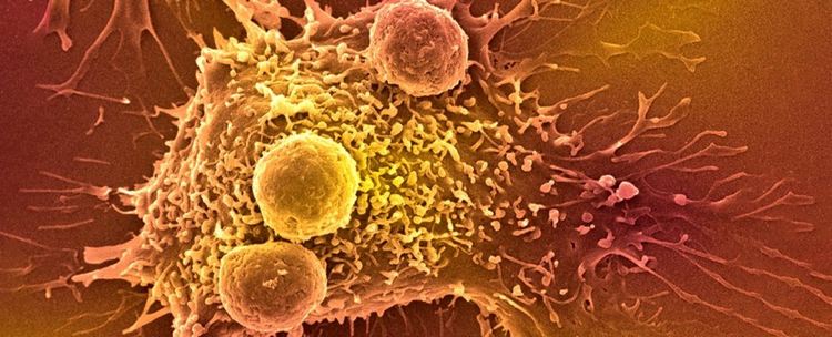 Нов кръвен тест засича 50 вида рак