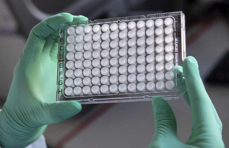 531 са потвърдените случаи на COVID-19 у нас, трима издъхнаха