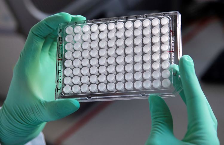 Скок на новите случаи на COVID-19 в Германия и в Сингапур