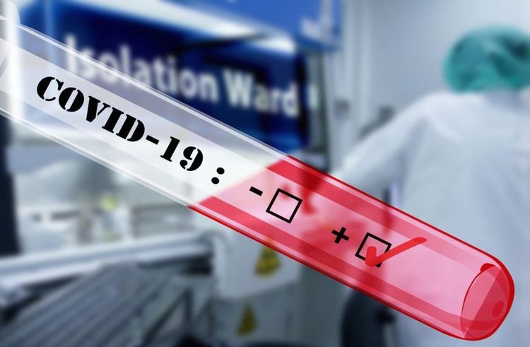 Още една медицинска сестра от Хасково е с коронавирус