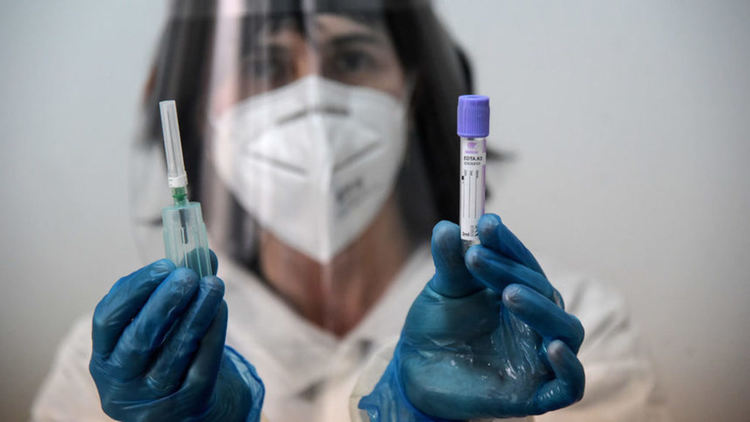 Колко безплатни ще са безплатните тестове за коронавирус